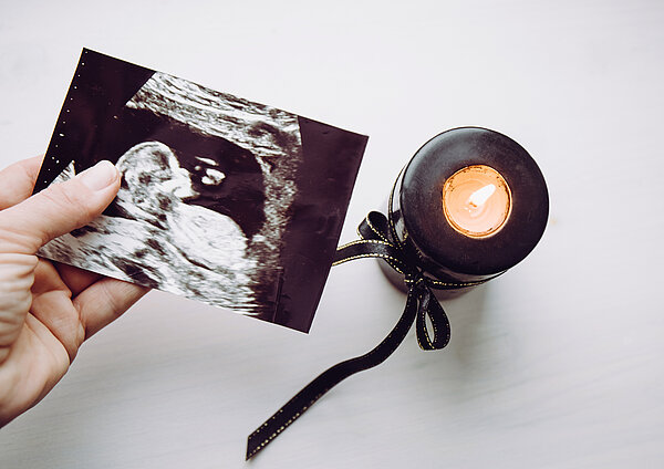 Konzeptuelles Bild einer trauernden Frau, Fehlgeburt. Mutterhand hält Ultraschallbild des Babys. Brennende schwarze Kerze.