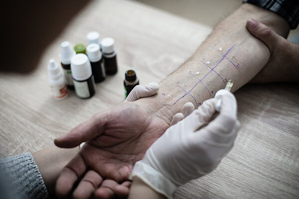 Ein Arzt macht bei einem Patienten den Prick-Test (Allergie-Test) auf dem Unterarm. 